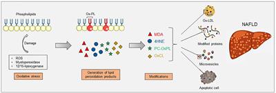 Oxidation-Specific Epitopes in Non-Alcoholic Fatty Liver Disease